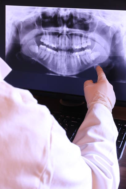 Best Emergency Treatment for Dental Infections or Abscesses in Barclay, NJ
